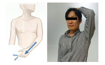 목디스크